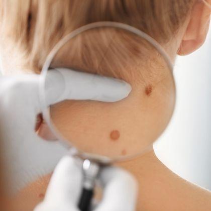 Dermatolog Osielsko
